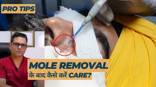 Care after Mole removal Skin tag and Wart removal  Post Mole removal Care  Dr Jangid  SkinQure [upl. by Ladd602]