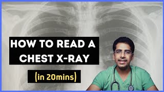 How to read a chest Xray in 20 mins [upl. by Akiv]