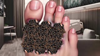 ASMR Foot Par Kide Lag Gaye  ASMR Belatung Infected Foot Cleaning  ASMR Cacing Massal [upl. by Azral]