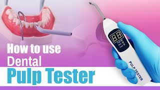 How to use Dental Pulp Tester  Waldent Pulp Tester [upl. by Inafets]