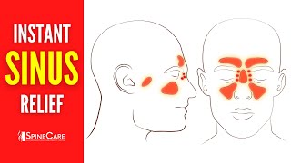 How to Relieve Sinus Congestion in 30 SECONDS [upl. by Norry]