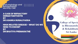 Refractory Dermatomyositis by Dr Asanka Nugaliyadda  IgG4 Related Disease by Dr Bhatiya Premaratne [upl. by Noremac]