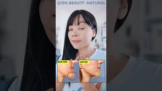 CHIN CORRECTION EXERCISE  Fix Protruding Chin Improve Chin Ptosis Witchs Chin [upl. by Akinnor]