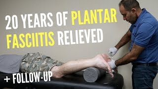 20 Years of Plantar Fasciitis RELIEVED With ASTR FOLLOWUP [upl. by Jana379]