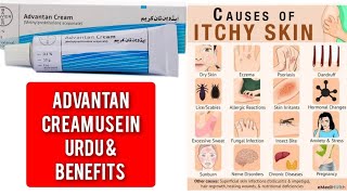 Advantan cream use in urdu amp benefits and side effects [upl. by Susanne]