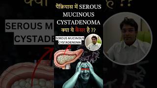 serous mucinous cystadenoma pancreas  serous mucinous cystadenoma is cancer  Pancreatic lesions [upl. by Akiam]