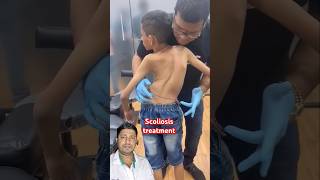 Treatment for scoliosis chiropractor physiotherapy baby shoulder scoliosistreatment funny [upl. by Artimid]