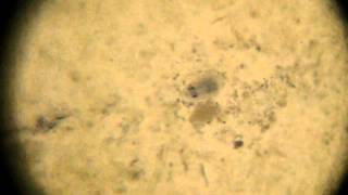 Giardia lamblia Cyst [upl. by Enymzaj745]