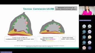 Ecografía mamaria [upl. by Ap409]