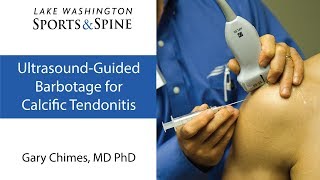 Ultrasoundguided Barbotage for Calcific Tendinitis [upl. by Mungam875]