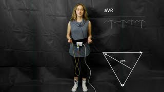 ECG The augmented limb leads aVF aVR and aVL [upl. by Heidie]