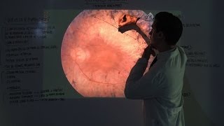 Retinosis Pigmentaria  Tipos y Tratamiento  Patología Ocular [upl. by Atina]