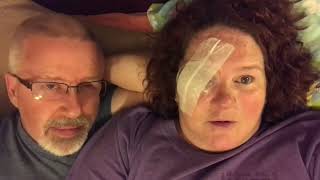 Cornea Transplant Days 4 amp 5 Post Op  Fuchs Dystrophy  Preparing to Full Time RV [upl. by Feinberg]