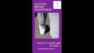 Gluteus Medius shortening in gait podiatry chiropractic gait glutes physiotherapy [upl. by Matilde]