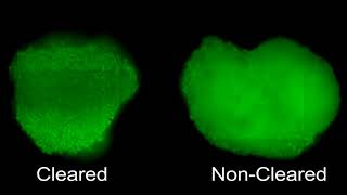 Tissue Clearing of HepG2 Spheroids for HCS [upl. by Carol-Jean297]