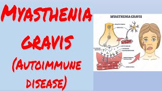 Myasthenia gravis  Autoimmune disease [upl. by Santoro]