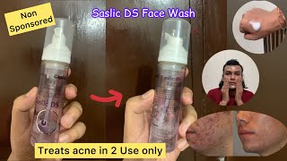 Saslic DS Face Wash Review  Saslic Foaming Face Wash Review [upl. by Heinrike92]