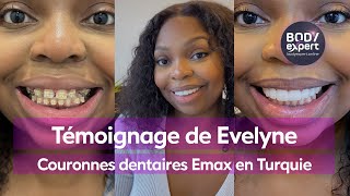 DENTISTE EN TURQUIE  🦷 Témoignage Evelyne  10 couronnes Emax  blanchiment  BODYEXPERT [upl. by Lathe]