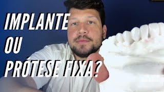 Implante ou prótese fixa  Dr Victor Hugo Almeida [upl. by Tatianas952]