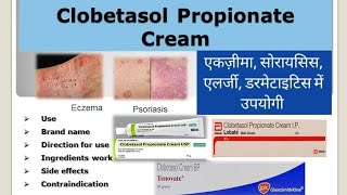 Clobetasol propionate cream information  Use Side effects Contraindication [upl. by Mogerly]