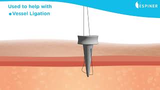 SuitORpass disposable suture passer and guide [upl. by Casta794]