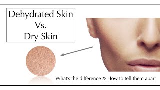 Dehydrated Skin Vs Dry Skin  Skin Condition Vs Skin Type [upl. by Ziegler]