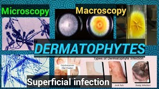 Fungal infectionFungal cultureFungal identificationDermatophytesDermatophytosisSTAR LABORATORY [upl. by Akela]