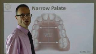 A Narrow Palate By Dr Mike Mew [upl. by Valery920]