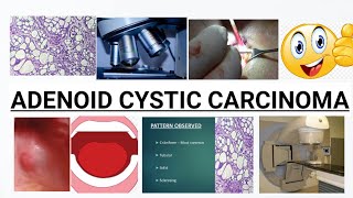 ADENOID CYSTIC CARCINOMA  COMPLETE DISCUSSION  IMAGES [upl. by Anhej]