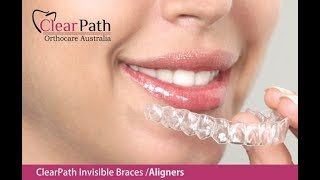 ClearPath Invisible Aligner Treatment Ahmedabad [upl. by Irot72]