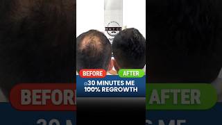 30 Minutes Me 100 Hair Regrowth  Hair Loss  Hair Tips  Hair Expert  Adon Hair Care [upl. by Girand]