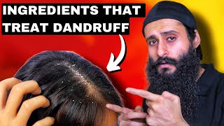 AntiDandruff Ingredients That You Should Know  Bearded Chokra [upl. by Olag358]