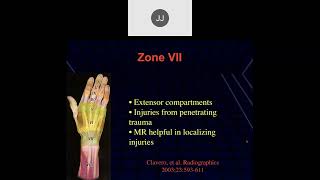 MRI of the Wrist Part 8  Wrist Tendons [upl. by Zuckerman]