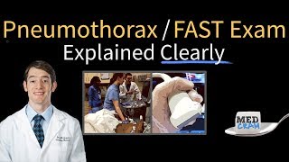 Pneumothorax on Ultrasound  FAST Exam Explained Clearly [upl. by Ettennor]