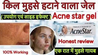 AcneStar Gel  Use Benefits Composition Side Effects and Price  How to Apply amp Precautions [upl. by Yajnas]