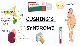 ‎⭕ شرح مفصل خطوة بخطوة لـ  Pathophysiology of Cushing’s Syndrome [upl. by Ahsier]