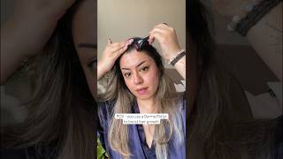 Derma Roller hair growth results are amazing Hair regrowth journey with derma roller 05 haircare [upl. by Rolyak107]