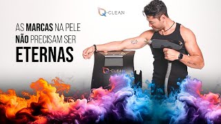 Renove Sua Pele Elimine Tatuagens e Pigmentos Indesejados com o Laser QClean [upl. by Anytsyrk]