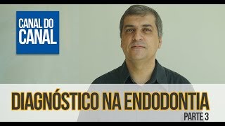 Video 3  Diagnóstico na Endodontia  Parte 3 [upl. by Bogusz]