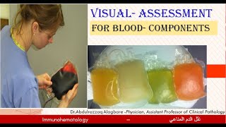 Lecture 2 19 Visual assessment for Blood Components [upl. by Akcire]