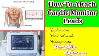 How to attach Cardiac monitor to the patient in urdu Hindi [upl. by Nollie836]