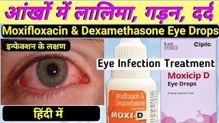 moxi d eye drops hindi  moxifloxacin and dexamethasone eye drops  moxicip eye drops in hindi [upl. by Aisile729]