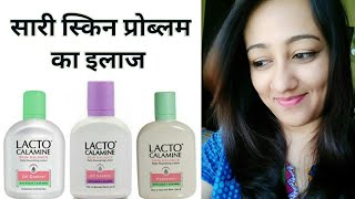 LACTO CALAMINE LOTION REVIEW IN HINDI FOR OILY amp DRY SKIN HOW TO APPLYUSE BENEFITS [upl. by Swift]