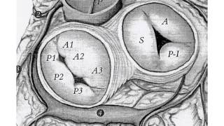 SEMIOLOGIE APPAREIL CARDIOVASCULAIRE LES SIGNES PHYSIQUES [upl. by Hcib]