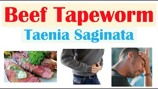 Beef Tapeworm Taeniasis  How It Infects Signs amp Symptoms Diagnosis Treatment Prevention [upl. by Zerat]