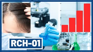 RCH01  Replicels new 2020 Hair Loss Treatment [upl. by Ahsenac438]