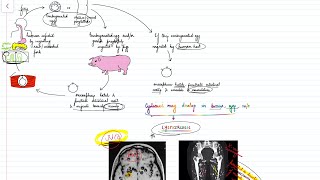 Taenia solium amp saginata Life cycle Neurocysticercosis Parasitology  neetpg inicet [upl. by Aritak]