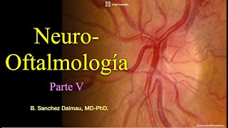 Neuroftalmología Parte V [upl. by Ayaet]