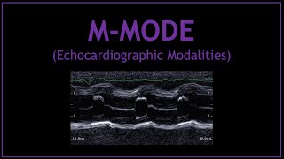 MMODE Echocardiographic Modalities [upl. by Eixid]