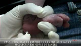 Forma Correcta de Recolectar la Muestra para el Tamiz Neonatal [upl. by Alayne]